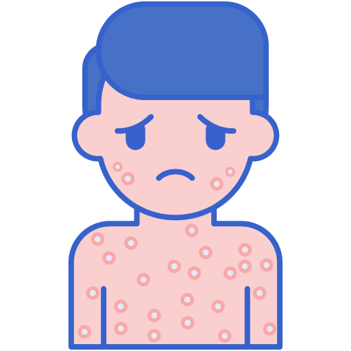 Chickenpox virus skin disease healthcare and medical icon