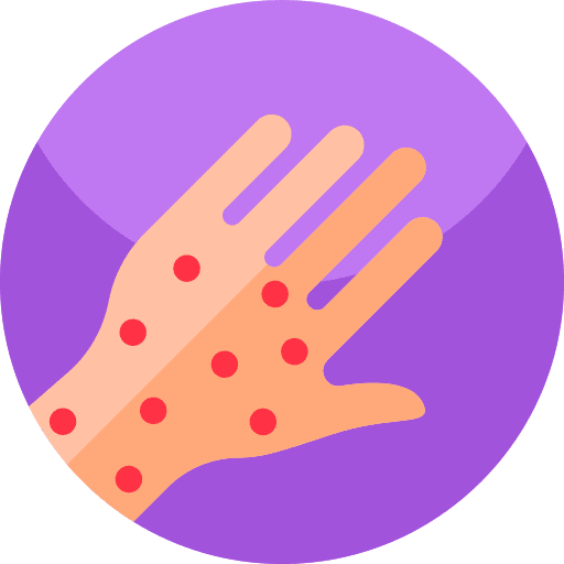 Smallpox chickenpox smallpox coronavirus icon