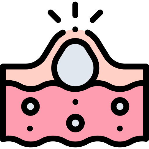 Acne acne dermathology epidermis icon