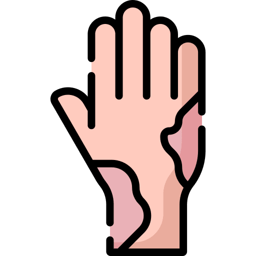 Eczema allergy healthcare and medical reaction icon