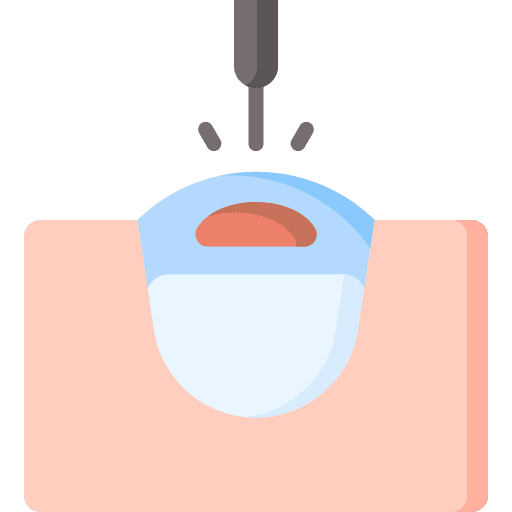 Laser surgery ophthalmology laser surgery healthcare and medical icon
