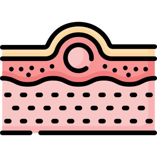 Acne beauty epidermis pores icon Acne beauty epidermis pores icon
