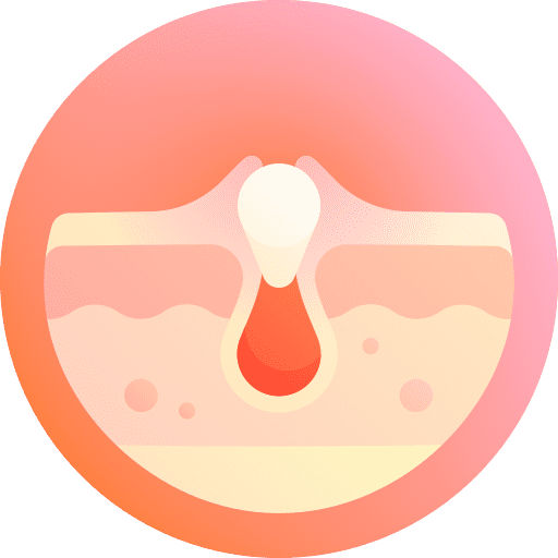 Acne healthcare and medical skin bacteria icon