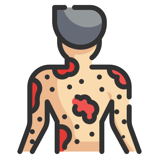 Allergy healthcare and medical bacteria reaction icon