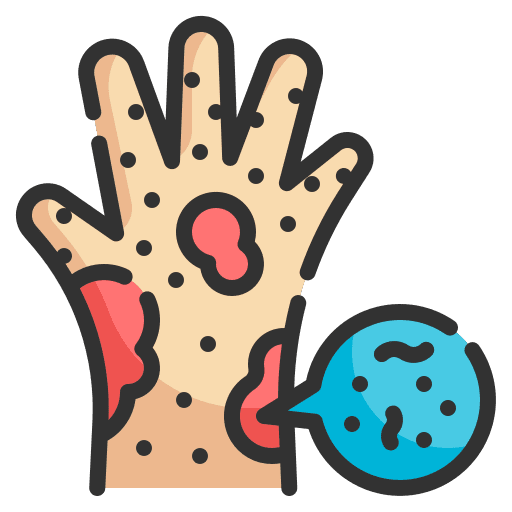 Allergy reaction skin hand icon Allergy reaction skin hand icon