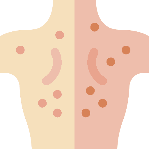 Acne healthcare and medical skin acne icon