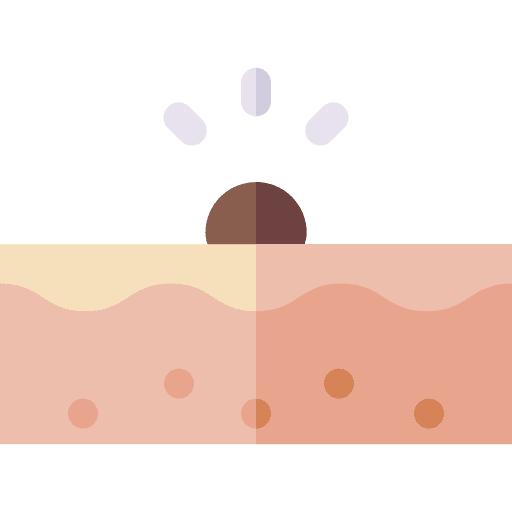 Mole healthcare and medical body wart icon