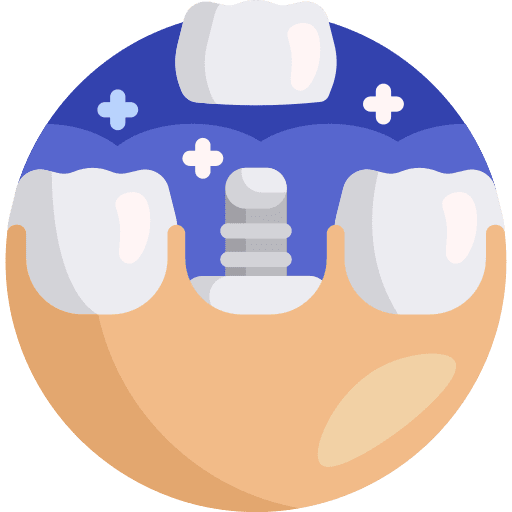 Implant dentist molar implant icon Implant dentist molar implant icon