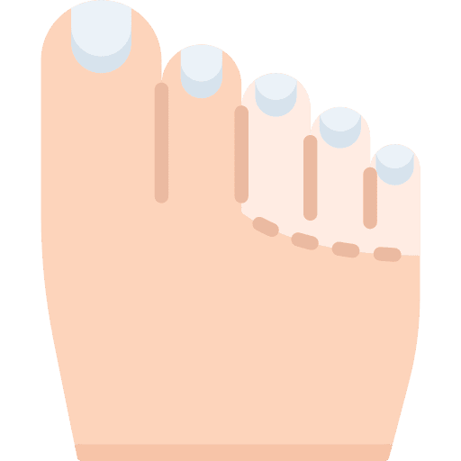 Loss of colour in toes covid 19 covid coronavirus icon Loss of colour in toes covid 19 covid coronavirus icon