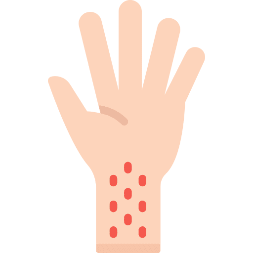 Skin rash reaction healthcare and medical eruption icon Skin rash reaction healthcare and medical eruption icon