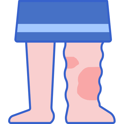 Lymphedema medical body disease icon