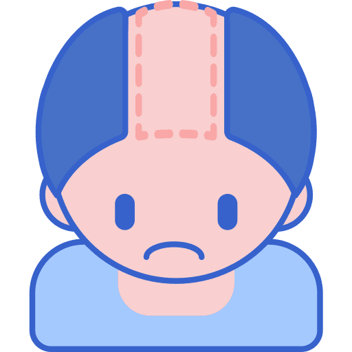 Hair loss anatomy hair loss body icon