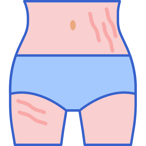 Stretch marks stretch marks skin people icon